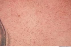 Photo Textures of Human Skin